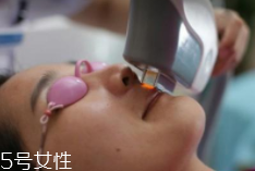 科技脫毛有哪些種類？冰點脫毛不毀毛囊