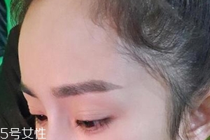 發(fā)際線高怎么治？拯救發(fā)際線攻略