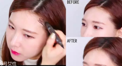 發(fā)際線高怎么治？拯救發(fā)際線攻略