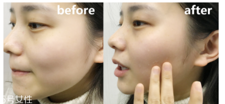 蘭蔻粉水適合什么年齡？只針對(duì)年輕肌底