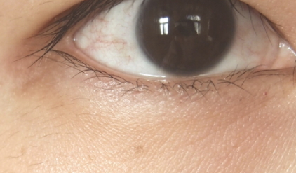 雅詩蘭黛適合敏感肌嗎？