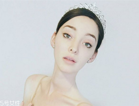 法令紋填充需要幾只玻尿酸？千萬(wàn)不可過(guò)量