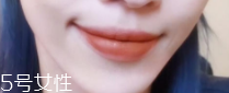 怎么變成櫻桃小嘴？大嘴唇變小攻略