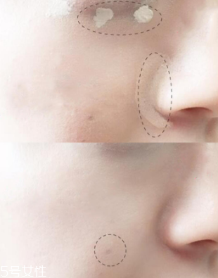 怎么遮瑕雀斑效果最好？雀斑遮瑕少不了遮瑕筆