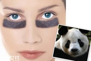 黑眼圈很重是什么原因？深扒三類黑眼圈的成因