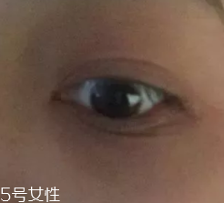 黑眼圈用什么眼霜好？多效護理型眼霜是首選