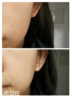 snail white蝸牛霜怎么打開？輕輕一按即有乳液滲出