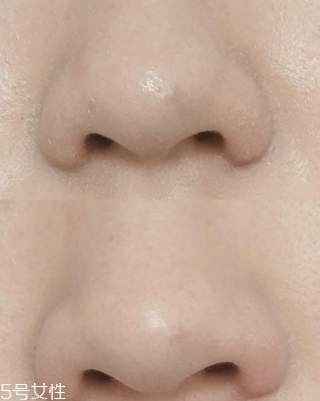 城野醫(yī)生收斂水可以每天用嗎？每天使用效果更佳