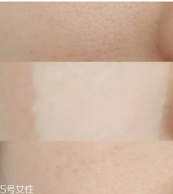 城野醫(yī)生收斂水可以每天用嗎？每天使用效果更佳