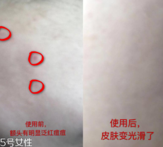 資生堂紅腰子適合什么年齡？最適合30歲以下人群