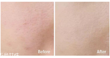 妮維雅小藍(lán)罐很油嗎？清爽不油膩