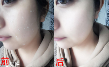 rosette去角質(zhì)凝膠怎么樣？真正的去角質(zhì)產(chǎn)品