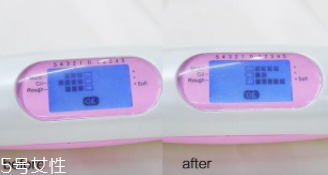 sk2神仙水適合油皮嗎？油皮親媽