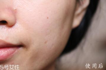 悅木之源和伊麗莎白雅頓哪個(gè)好？兩款精華大比拼