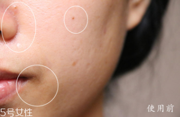 悅木之源和伊麗莎白雅頓哪個(gè)好？兩款精華大比拼