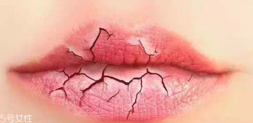 唇紋深適合什么口紅？別用啞光口紅