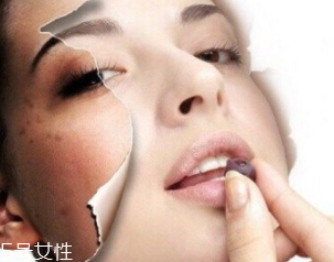 春季如何預(yù)防皮膚過敏？選擇敏感肌專用護(hù)膚品