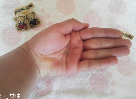 柳屋生發(fā)水有用嗎？一個(gè)月后長(zhǎng)出新發(fā)