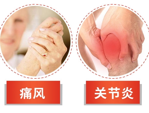 blackmores澳佳寶西芹籽怎么服用？