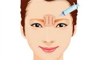 川字紋可以手術(shù)去除嗎？選擇手術(shù)需謹(jǐn)慎