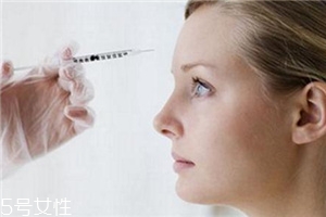 川字紋可以打玻尿酸嗎？不是最佳選擇