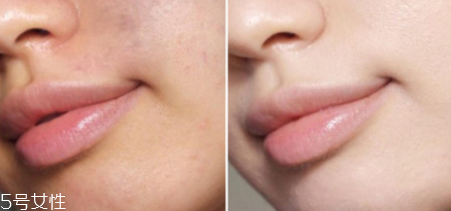 得鮮遮瑕液哪個色號好？1.5號色適合自然膚色