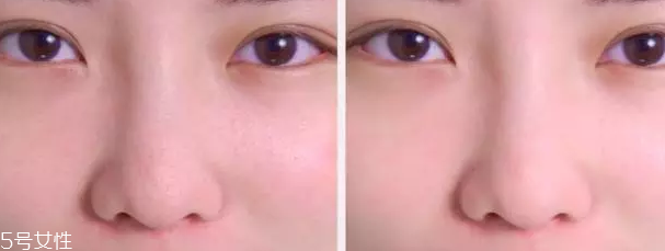 草莓鼻用什么產(chǎn)品最有效？4款產(chǎn)品讓鼻頭亮麗潔凈