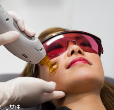 唇毛怎么去掉小竅門 4種常見去毛方法的優(yōu)缺點(diǎn)