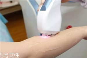 脫毛儀可以脫發(fā)際線嗎？脫了還會再長