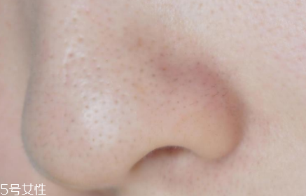 薇姿魔幻水怎么樣？薇姿水光煥亮角質(zhì)調(diào)理液好用嗎？