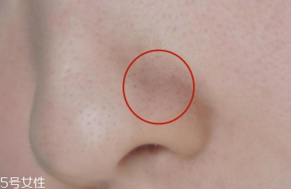 薇姿魔幻水怎么樣？薇姿水光煥亮角質(zhì)調(diào)理液好用嗎？