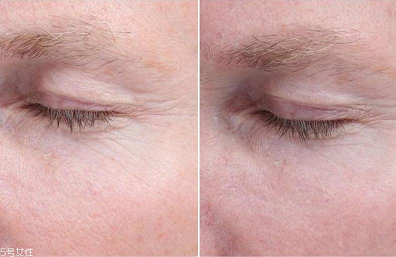 經(jīng)常熬夜用什么精華？3款實(shí)力派養(yǎng)出嫩膚新境界