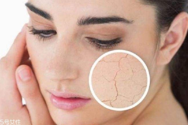 護(hù)膚水用了臉上刺痛怎么回事？這3點(diǎn)是關(guān)鍵