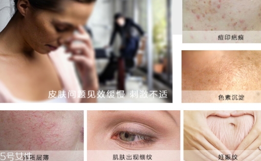 德國krauterhof蝸牛精華膏效果怎么樣？