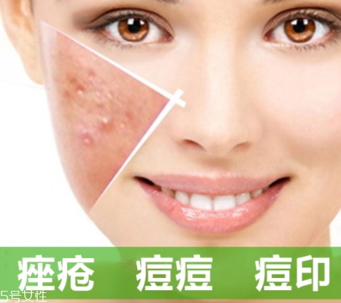 a酸怎么用？a酸怎么建立耐受？