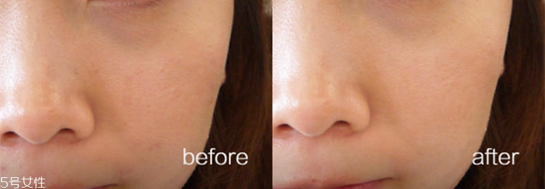 悅詩(shī)風(fēng)吟慕斯清潔面膜溫和嗎？干皮慎用