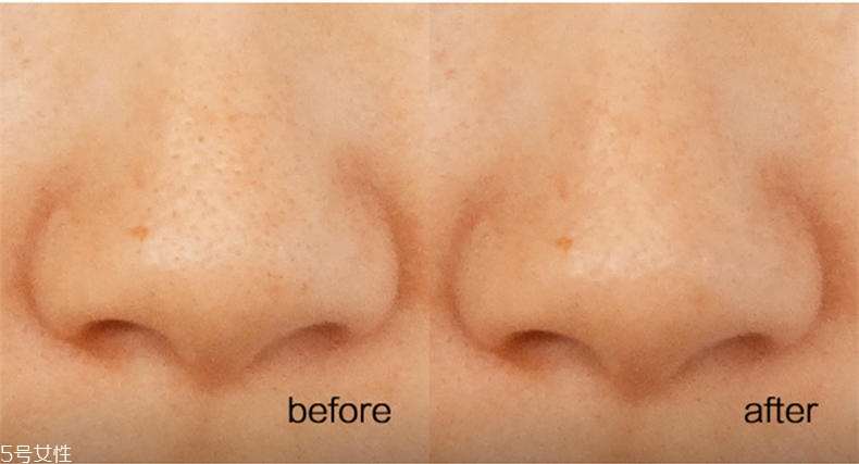 悅詩(shī)風(fēng)吟慕斯清潔面膜溫和嗎？干皮慎用