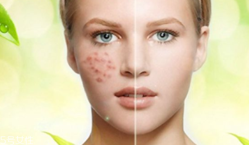 痘印顏色加深是怎么回事？補(bǔ)水還不夠