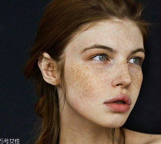 祛斑反彈是什么原因？一定沒注意這4點