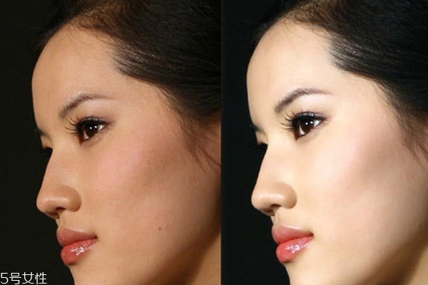 23歲應(yīng)該怎么護膚？不注意這3點你比閨蜜還顯老