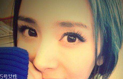 葉黃素能治白內(nèi)障嗎？有一定改善作用