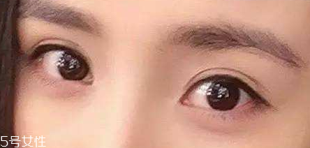 葉黃素能治療夜盲癥嗎？看什么類型的