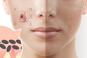 去角質(zhì)啫喱多久用一次？