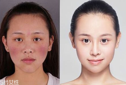 紅血絲用什么顏色的隔離好 紅血絲自然消除法 紅血絲用什么顏色的隔離好 紅血絲自然消除法