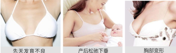 豐胸霜怎么用？豐胸霜使用手法詳解