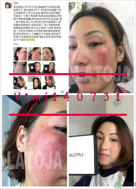 涵曦排毒針效果怎么樣？涵曦新品排毒針安全有副作用嗎？