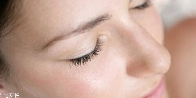 皮膚出油是因?yàn)轵x(chóng)嗎 臉上有螨蟲(chóng)的征兆