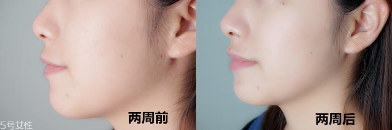 歐緹麗美白精華水怎么樣 歐緹麗美白精華水真人實(shí)測