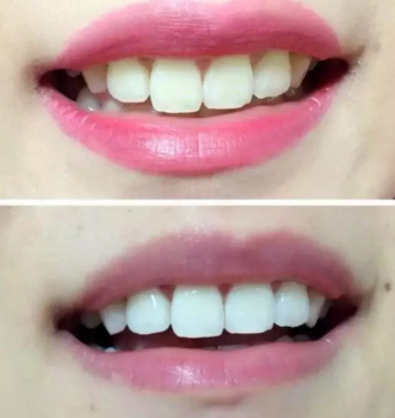 mistine美牙筆怎么用？mistine美牙筆評測