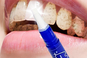 mistine美牙筆怎么用？mistine美牙筆評測